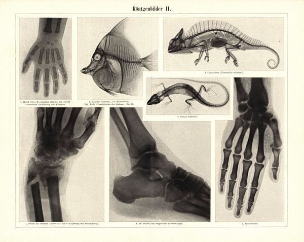 Röntgenbilder. Buchillustration (Stich) von 1898